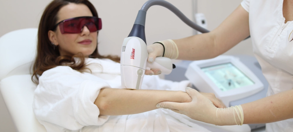 Лазерная эпиляция