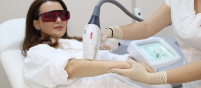 Лазерная эпиляция