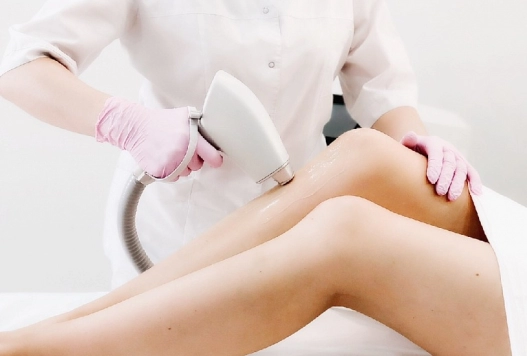 Ожоги после лазерной эпиляции