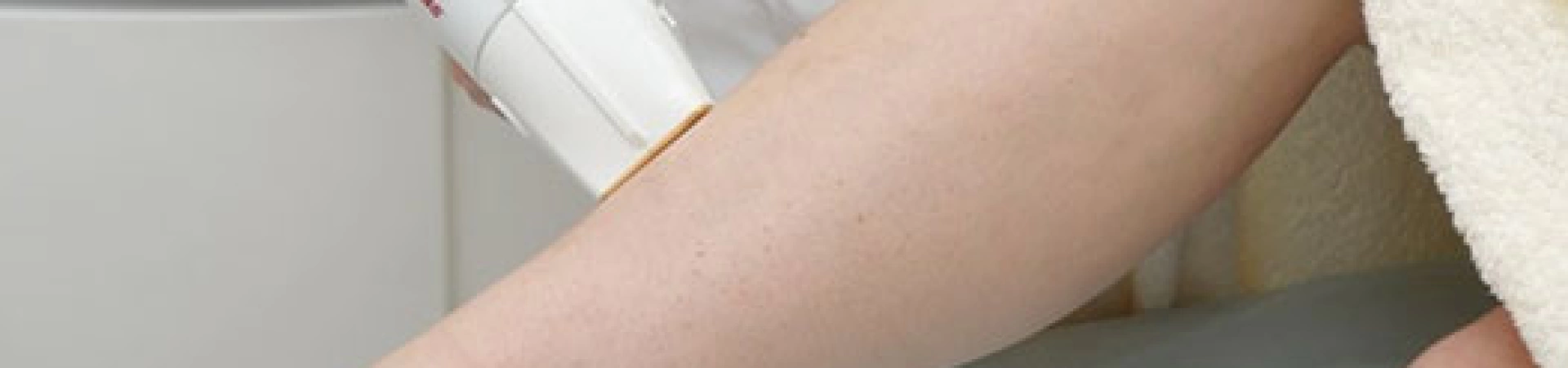 Часто задаваемые вопросы про Лазерную эпиляцию