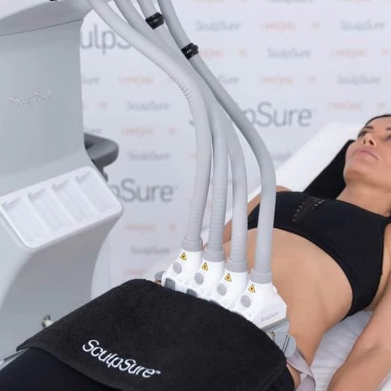 Лазерный липолиз на аппарате SculpSure для коррекции фигуры