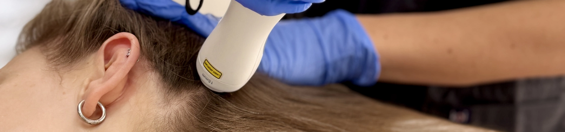 Новинка! Лазерное стимулирование роста волос