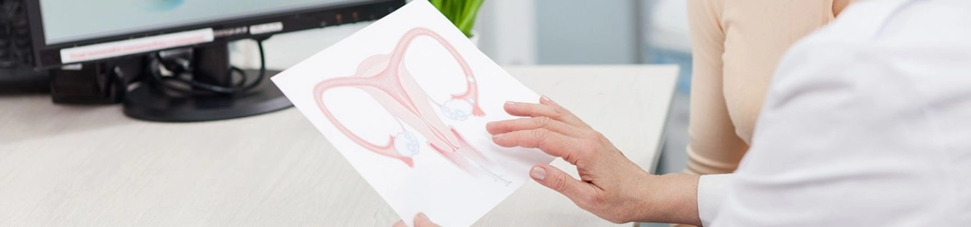 Лечение недержания мочи Femilift