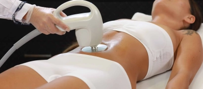 Радиоволновой RF-Лифтинг