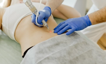 Удаление новообразований