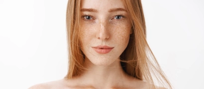 Лечение глубокой пигментации лазером (мелазмы)