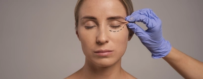 Блефаропластика