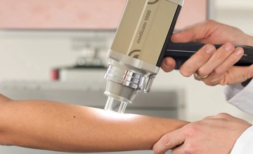 Дерматоскопия – диагностика новообразований кожи