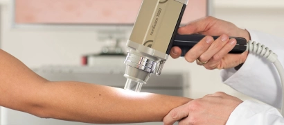 Дерматоскопия – диагностика новообразований кожи