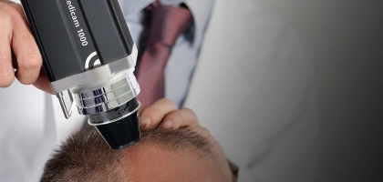 Диагностика волос и кожи головы