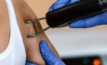 Лечение шрамов, рубцов