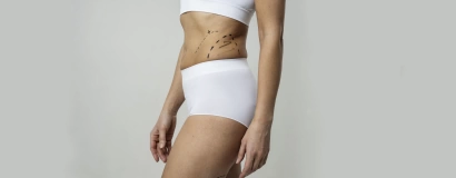 Бодилифтинг (подтяжка тела)