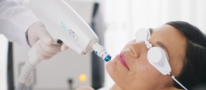 Неабляционное лазерное омоложение