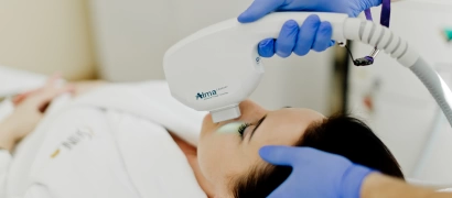 Фотоомоложение