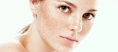 Лечение поверхностной пигментации фотонасадкой