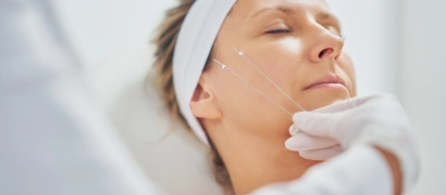 Нитевой лифтинг