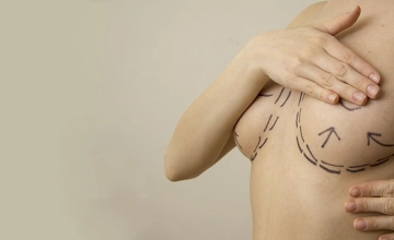 Коррекция груди (деформация, асимметрия)