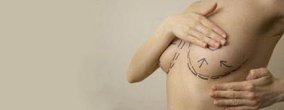 Коррекция груди (деформация, асимметрия)