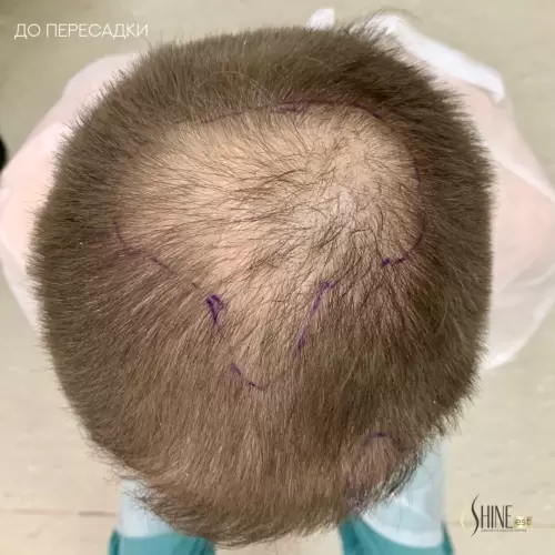 До пересадки | Shine-est.by