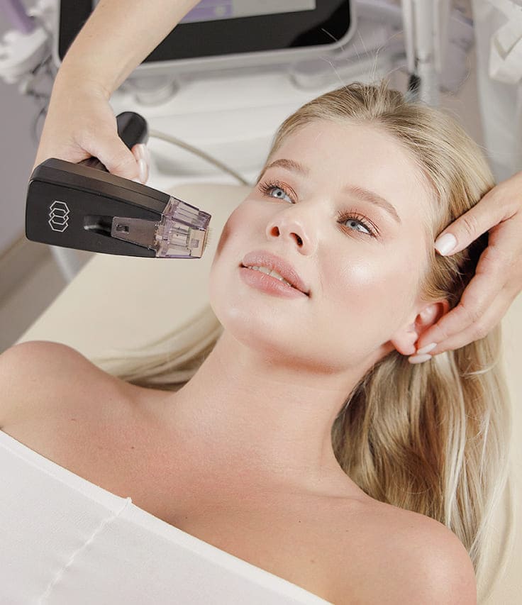 Преимущества микроигольчатого RF-лифтинга Morpheus 8