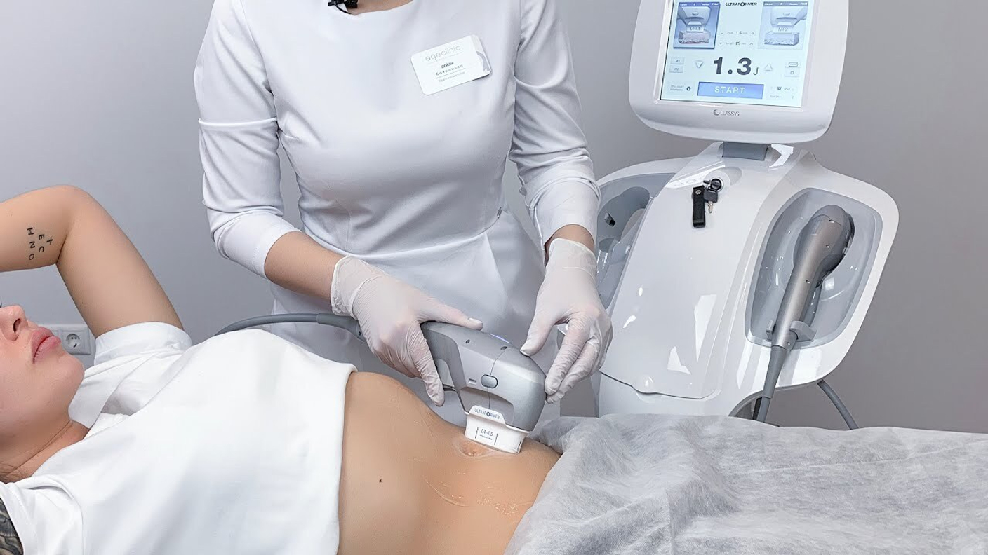 Все о SMAS-ЛИФТИНГЕ