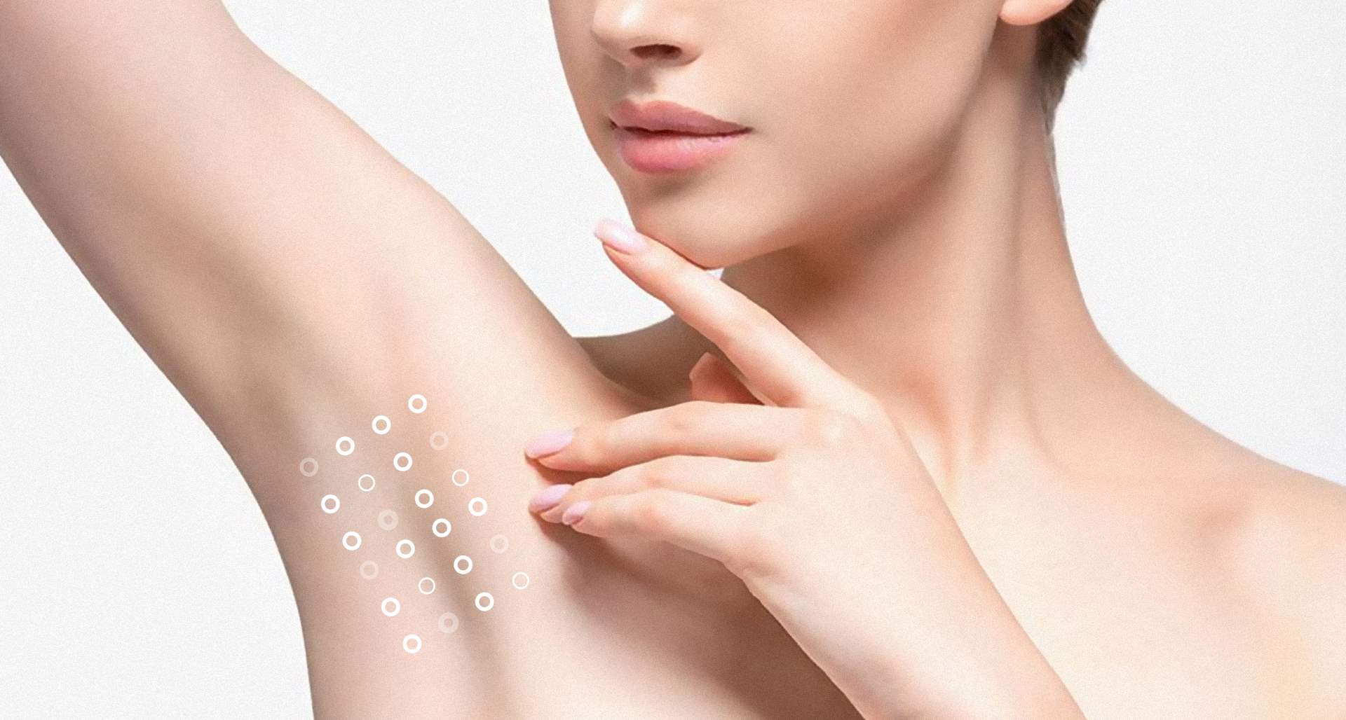 Гипергидроз: что это и как решить проблему?