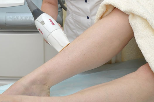 Часто задаваемые вопросы про Лазерную эпиляцию