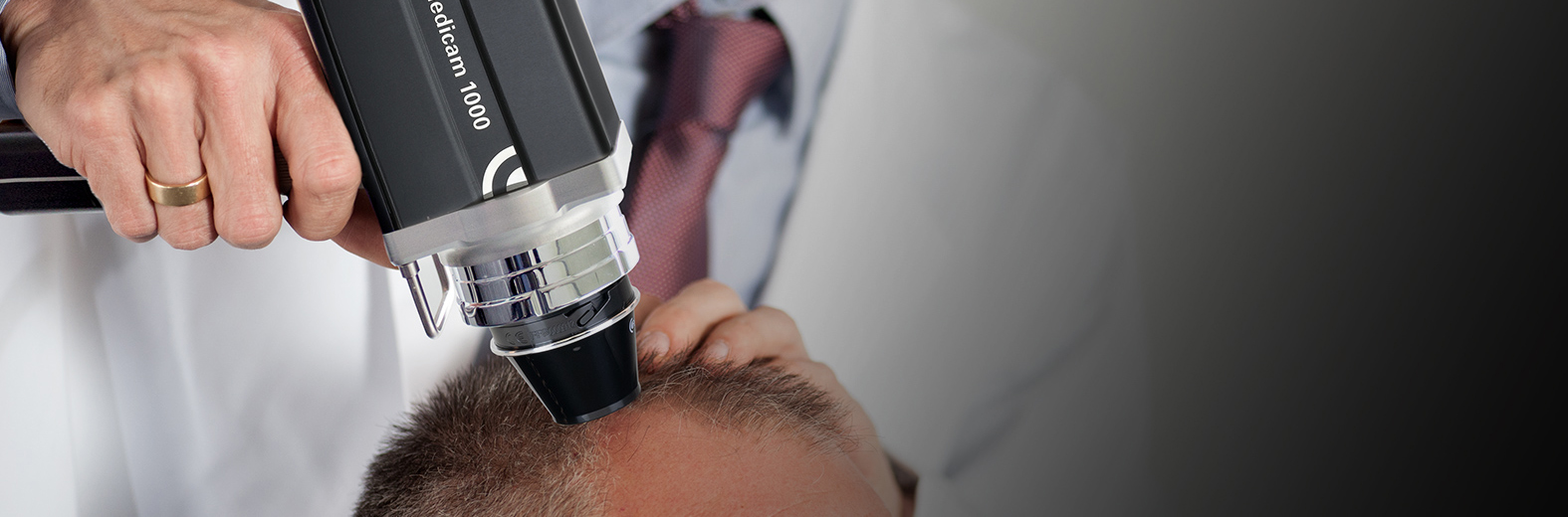 Диагностика волос и кожи головы