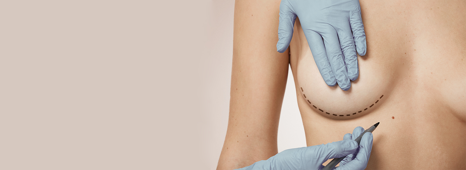 Повторные операции на груди