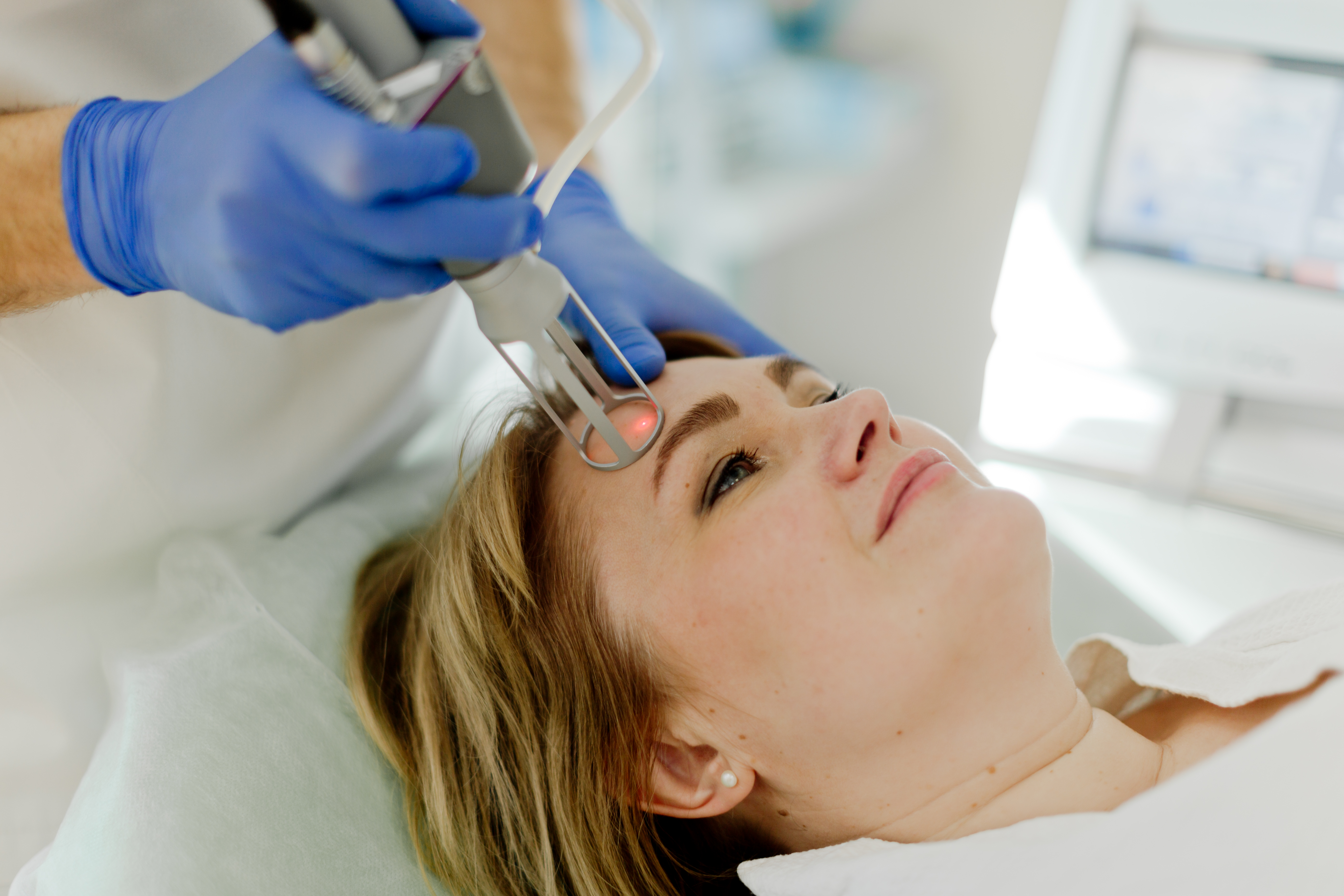 Фракционное аблятивное омоложение (шлифовка)